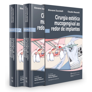 Cirurgia Estética Mucogengival Ao Redor De Implantes - Vol 1 e 2