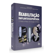 Reabilitação Implantossuportada - O Passo A Passo Da Cirurgia Á Prótese